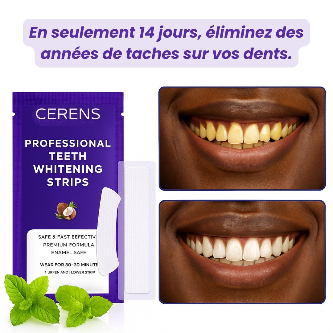 Bandes Blanchissantes Express -Sourire Éclatant CERENS