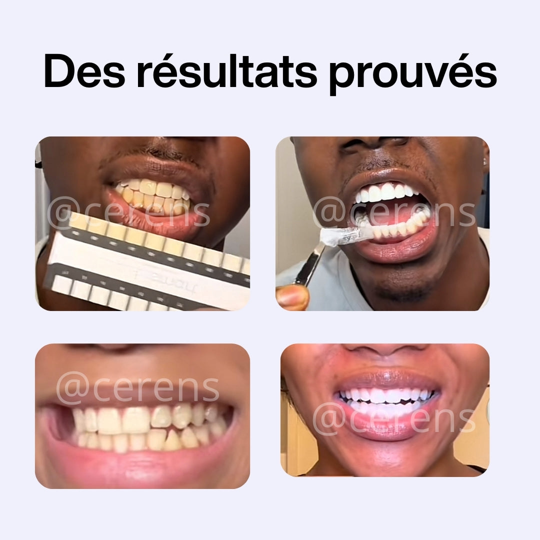 Bandes Blanchissantes Express -Sourire Éclatant CERENS