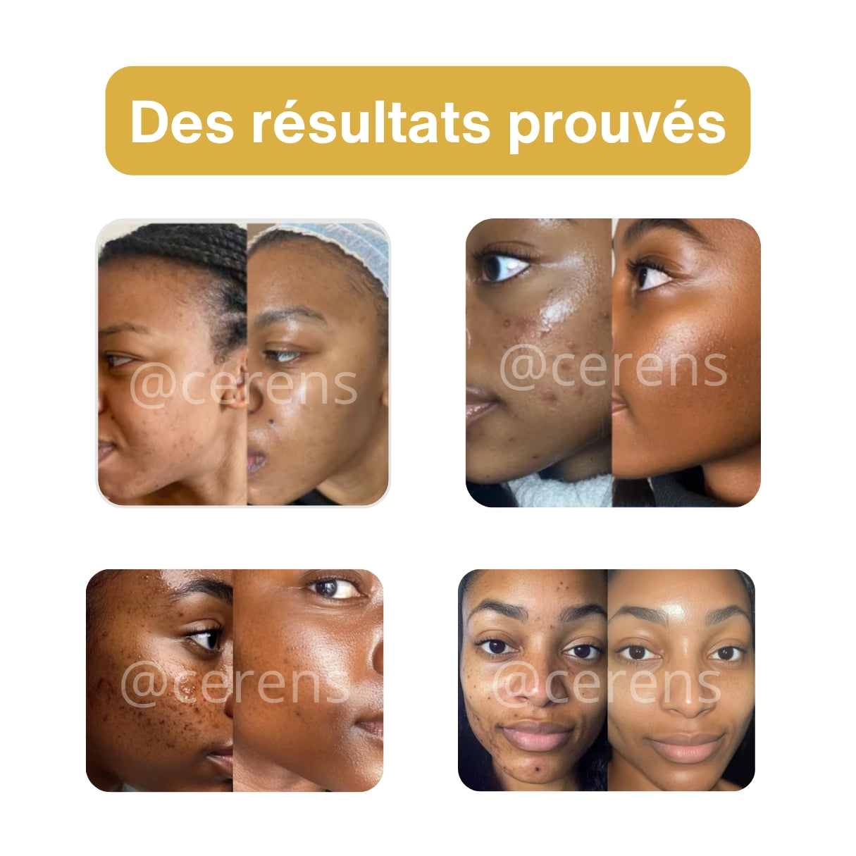 Masque Précieux Or 24K CERENS – Peau Radieuse & Lumineuse