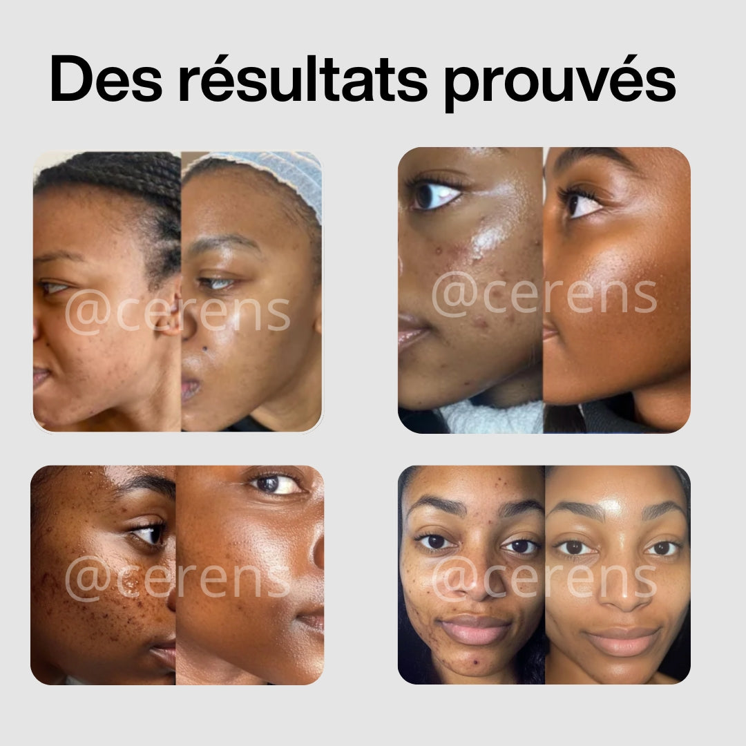 Cotons curcuma CERENS – Cible les taches, révèle l’éclat, unifie le teint