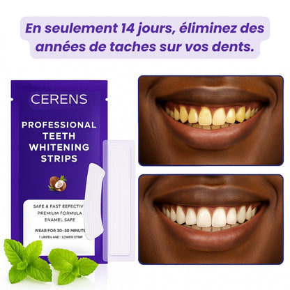 Bandes Blanchissantes Express -Sourire Éclatant CERENS