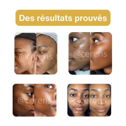 Masque Précieux Or 24K CERENS – Peau Radieuse & Lumineuse